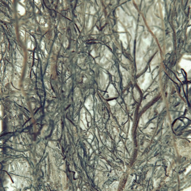 root15alt