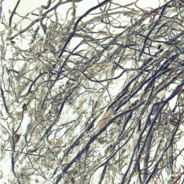 root1alt
