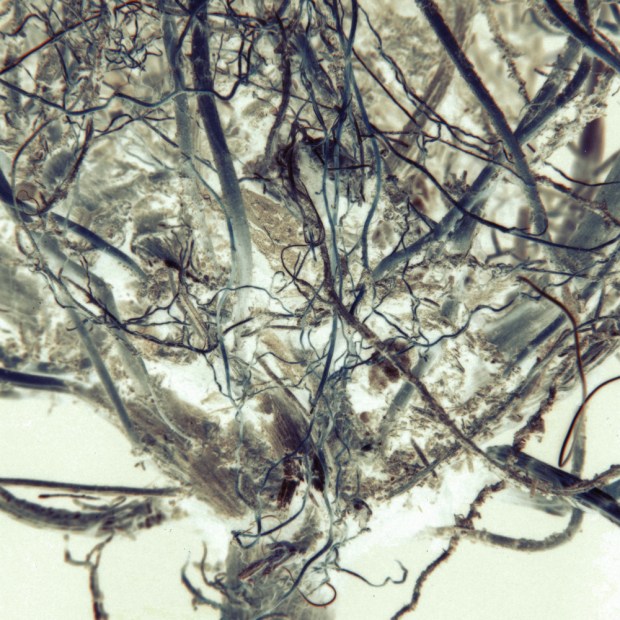 root22alt